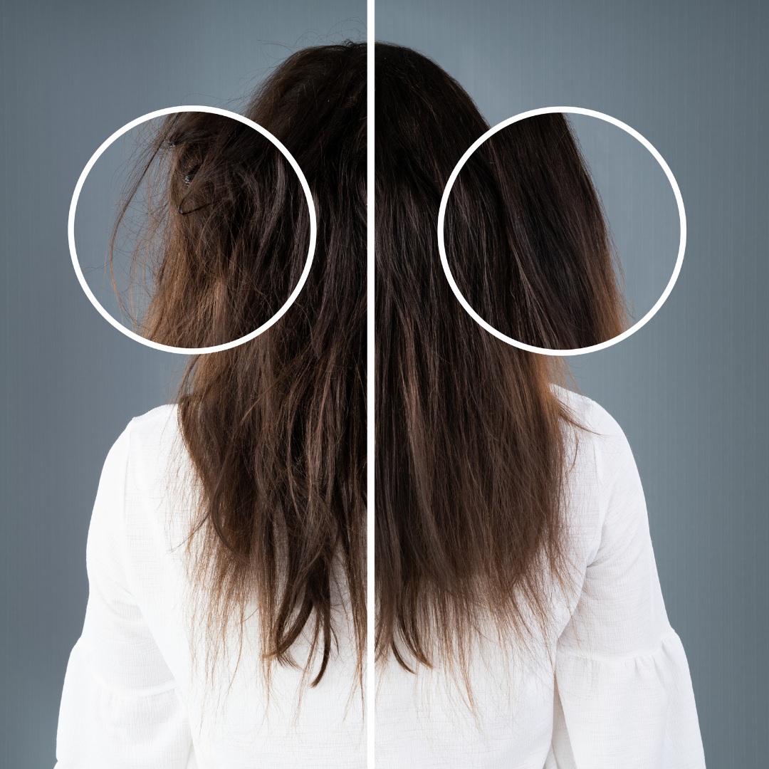 Hair Density Improvement Process